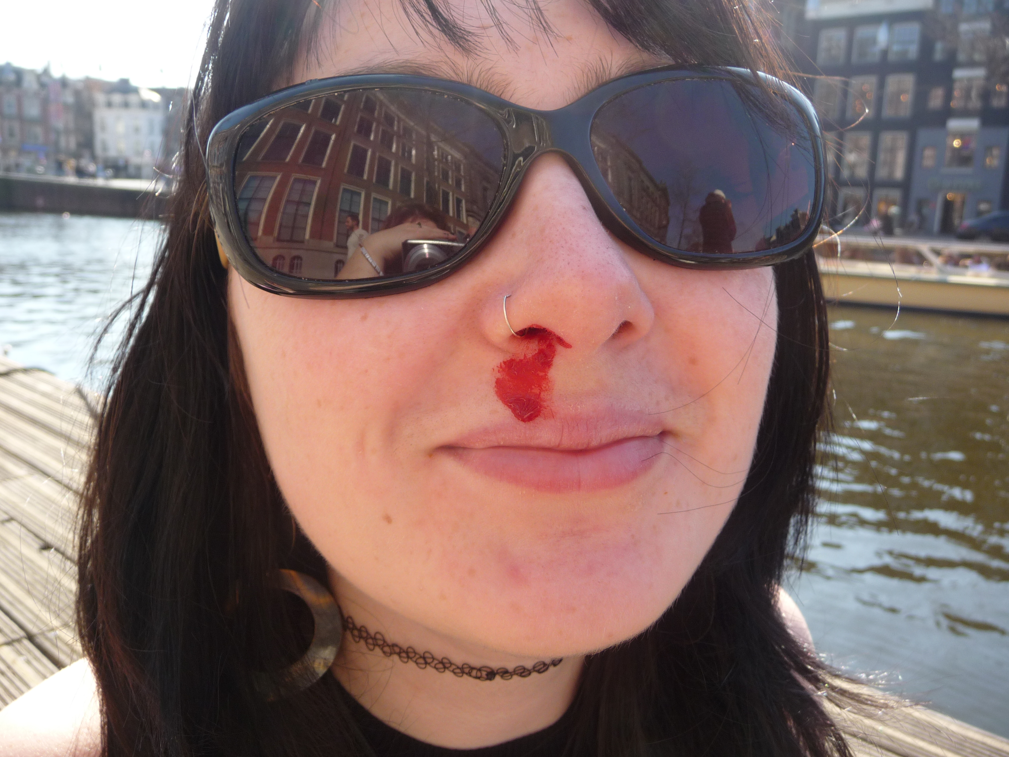 me with a bloody nose and prescription sunglasses